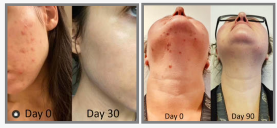 Image Title Skinade Targeted Solutions - Clear